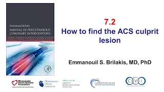 7.2 Manual of PCI - Finding the ACS culprit