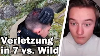 Die erste VERLETZUNG in 7 vs. Wild! Reaktion auf 7 vs. Wild / 2 Folge