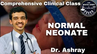 Normal Neonate case presentation