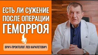 Есть ли сужение после операции ГЕМОРРОЯ?