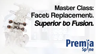 Master Class: Facet Replacement. Superior to Fusion