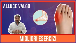 ALLUCE VALGO: i 5 MIGLIORI ESERCIZI per RIDURLO VELOCEMENTE