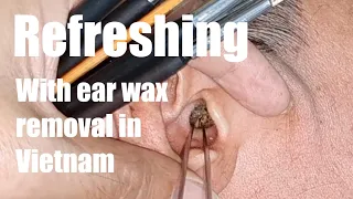 Ear wax removal real person realaxing with barber Vietnam