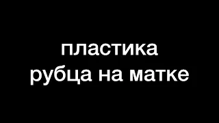 пластика рубца на матке после кесарева сечения