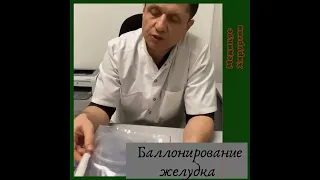 Внутрижелудочный баллон