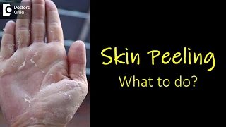 What causes skin peeling from fingers and feet? How to manage? - Dr. Rasya Dixit