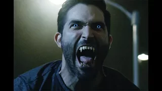 Teen Wolf Control