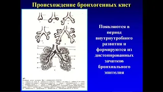 Пороки развития легких