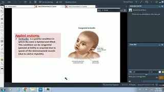 Posterior Triangle of Neck & Sternomastoid Muscle - Dr. Ahmed Farid