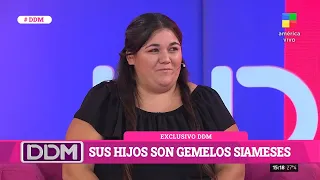 La historia de Belén: sus hijos son gemelos siameses