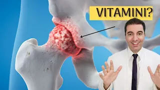 THE MOST IMPORTANT VITAMINS FOR HIP ARTHROSIS! Prevent cartilage damage, pain, stiffness ...