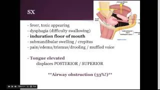 Ludwig's angina:  "EM in 5"