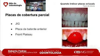 Quando indicar Placas Oclusais: Tipos de placas - Roberto Pedras - III Semana da Odontologia