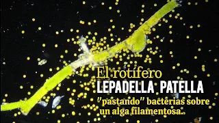 Lepadella patella (Rotífero) + Trachelomonas volvocina (Euglenófito)