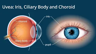 Uveal Tract Anatomy | Iris | Ciliary Body |  Choroid | Eye Anatomy