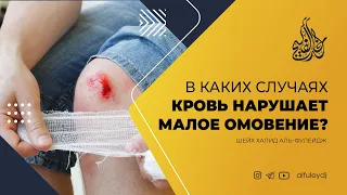 В каких случаях кровь нарушает малое омовение? — Шейх Халид аль-Фулейдж