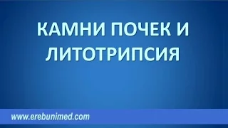 Инновационные методы лечения камней почек. Литотрипсия.