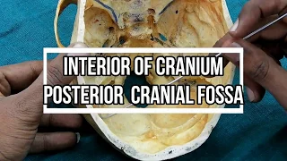 Posterior Cranial Fossa