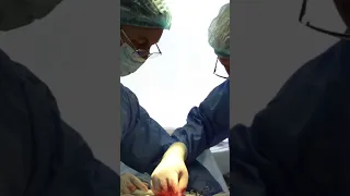 #doctors #surgery #operation  Злагоджена робота лікарів під час операції