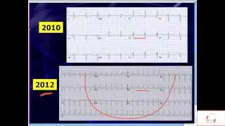 EMRAPTV:132 Wide Complex Tachycardia