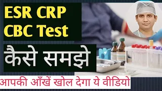 ESR ,CRP, CBC टेस्ट क्यों करवाये जाते है! इनको घर पर कैसे समझे !! / importance of  CBC, ESR and CRP.