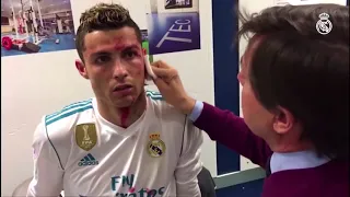 BEHIND THE SCENES: Cristiano Ronaldo BLOOD ON FACE AFTER INSANE KICK