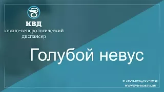 360  Голубой невус