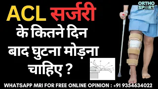 ACL सर्जरी के कितने दिन बाद घुटना मोड़ना चाहिए ? Knee Bending after ACL Surgery