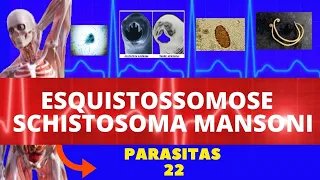 ESQUISTOSSOMOSE - SCHISTOSOMA MANSONI (VERMINOSE) - PARASITOLOGIA| INFECTOLOGIA