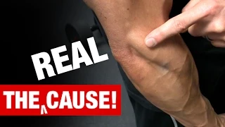 The Truth About Tennis Elbow (WHAT REALLY CAUSES IT!)