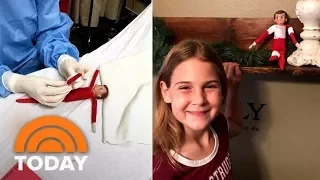 Elf On The Shelf Gets Sewn Up In ER After Encounter With Family Dog | TODAY