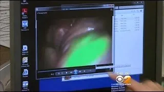 Dr. Max Gomez: Green Glow Cancer Test