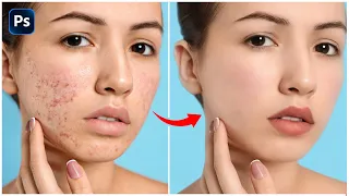 Skin Retouching 2024 | High-End Face Retouching - Best Photoshop Tutorial