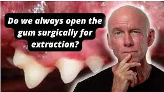 Do we always open the gum surgically for extraction ?