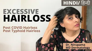 Hair loss causes, treatment| Post COVID hair loss | Hair loss in females| excessive hairloss