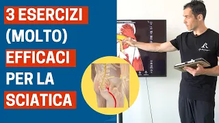 3 esercizi (molto) efficaci per la SCIATICA