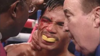 📅 ON THIS DAY! MANNY PACQUIAO FACED HIS 'DIRTIEST' OPPONENT IN AGAPITO SANCHEZ (HIGHLIGHTS) 🥊