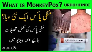 Monkeypox explained in Urdu/Hindi | Adab Diary | ZA