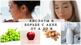 КИСЛОТЫ В БОРЬБЕ С АКНЕ ОТ А ДО Я. Как избавиться от прыщей? #акне #проблемнаякожа #прыщи