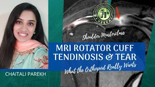 MRI SHOULDER MASTERCLASS | CHAITALI PAREKH | ROTATOR CUFF TEAR | TENDINOSIS | WHAT ORTHOPOD WANTS