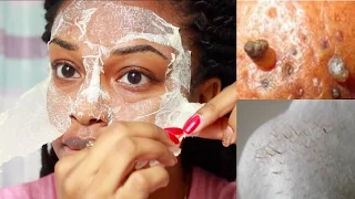 EASY DIY Egg Blackhead Remover Peel Off Mask