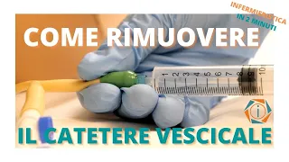 COME RIMUOVERE IL CATETERE VESCICALE | INFERMIERISTICA IN 2 MINUTI | INFERMIERI online