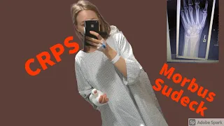 Ich habe CRPS / Morbus Sudeck! Was ist das überhaupt?