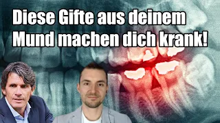 Diese Gifte in deinem Mund machen dich krank! Amalgam, NICO, Wurzelbehandlung | Dr. Ulrich Volz