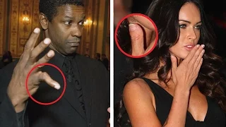 Top 5 Celebrities With Physical Deformities