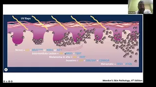 21st Century Dermatopathology: Molecular Diagnostics for Melanocytic Neoplasms