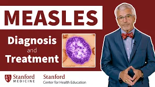 How is measles diagnosed and treated? | Stanford