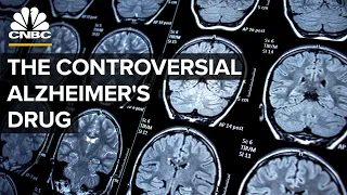 What’s The Controversy Behind Biogen’s Alzheimer’s Drug?