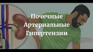 Почечные Артериальные Гипертензии - Этиология, Клиника, Симптомы, Диагностика, Лечение (Терапия)