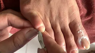 deep leg skin cutting technique#260